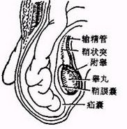 小肠疝气图片