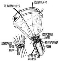 哪些人会得股疝